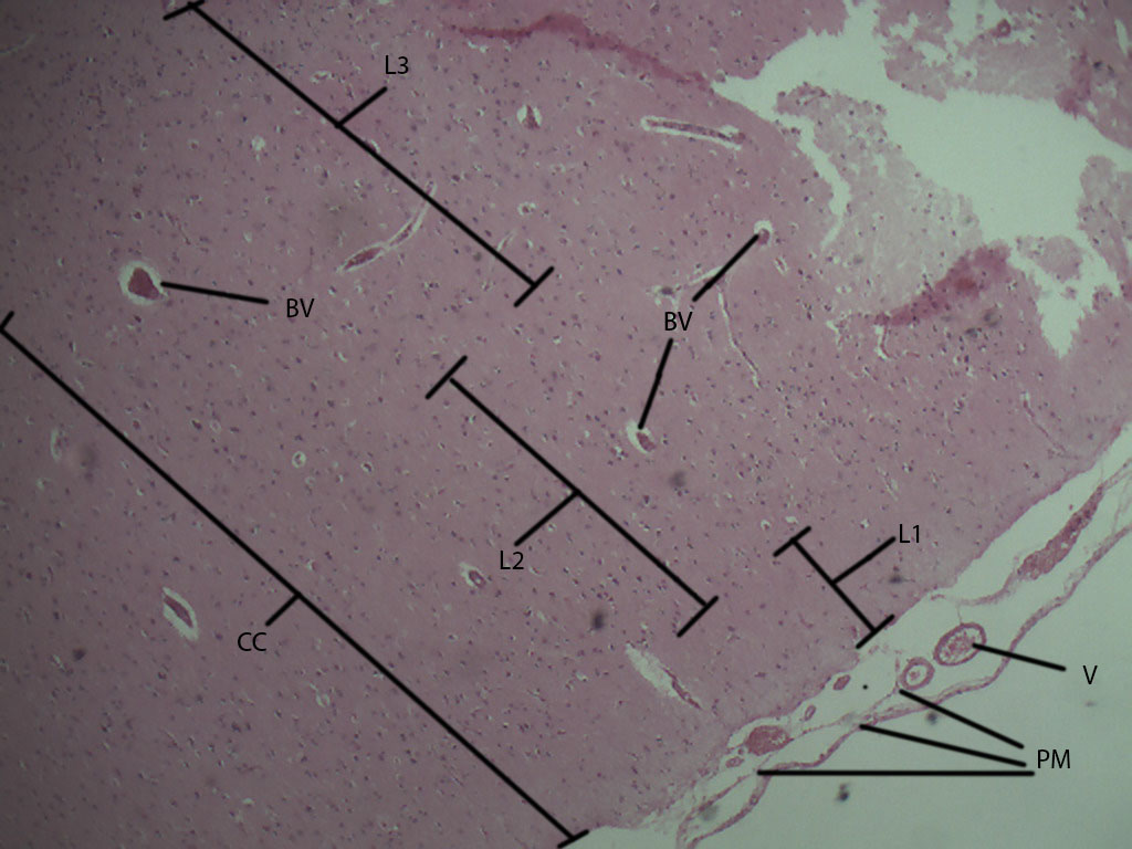 Human Cerebral Cortex Through 4x Objective Histology